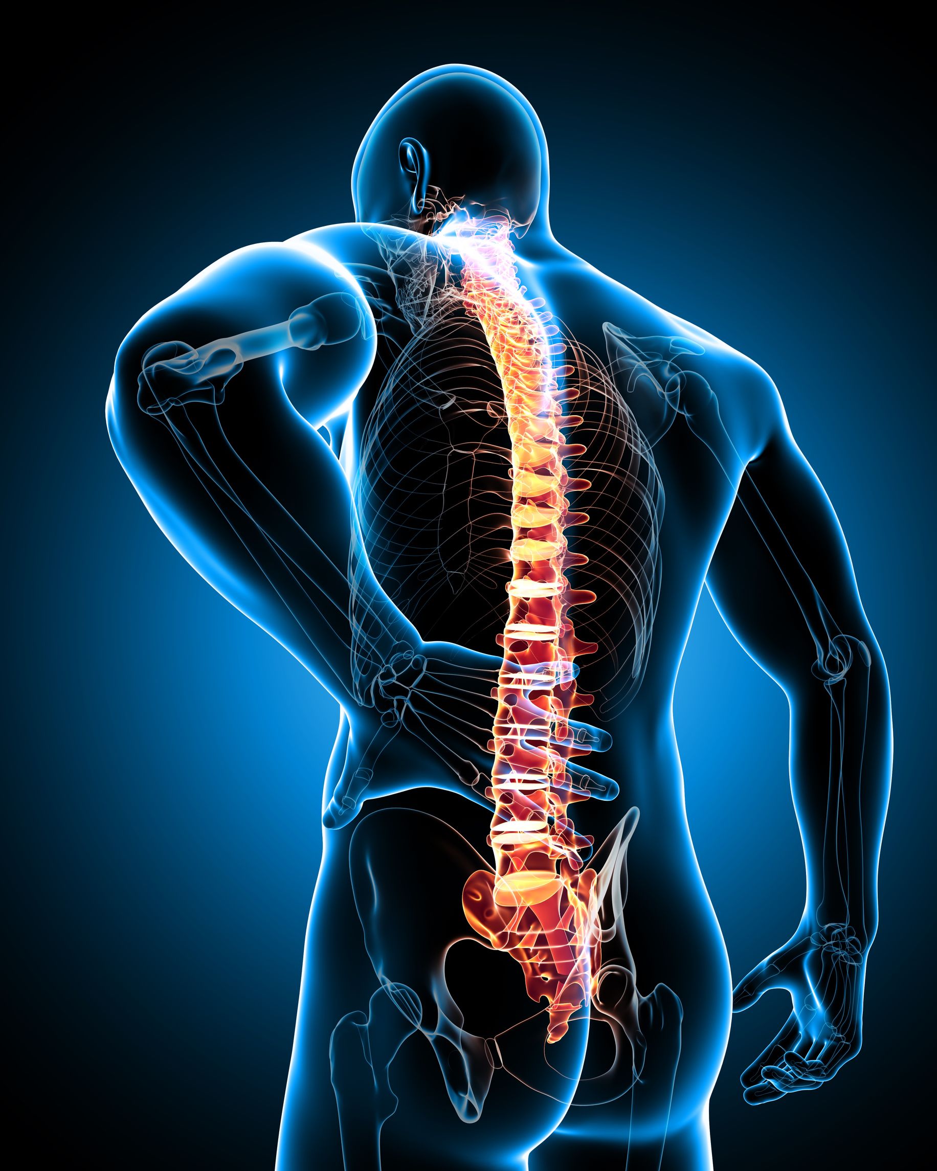Tips for Getting On the Road to Recovery From Spinal Fusion Surgery