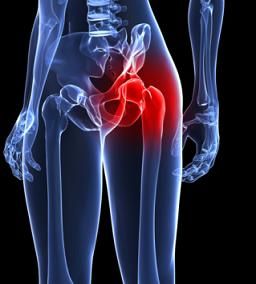 hip-pain-6.jpg