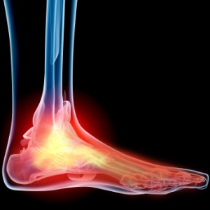 foot-pain.jpg
