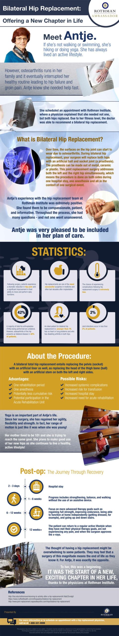 Bilateral Hip Replacement Procedure | Rothman Orthopaedic Institute