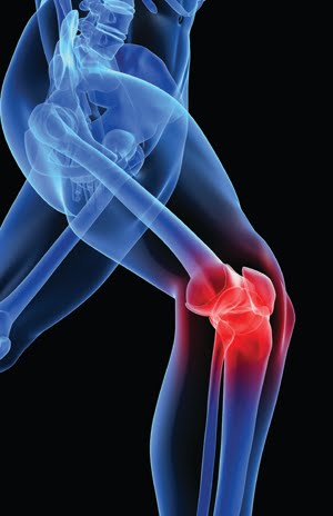arthritis-knee-pain.jpg