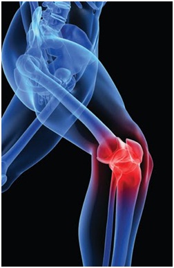 knee-pain-2.jpg