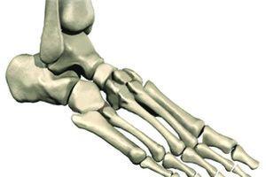 Corns and Calluses: Your Questions Answered by Callus Physicians in South Jersey