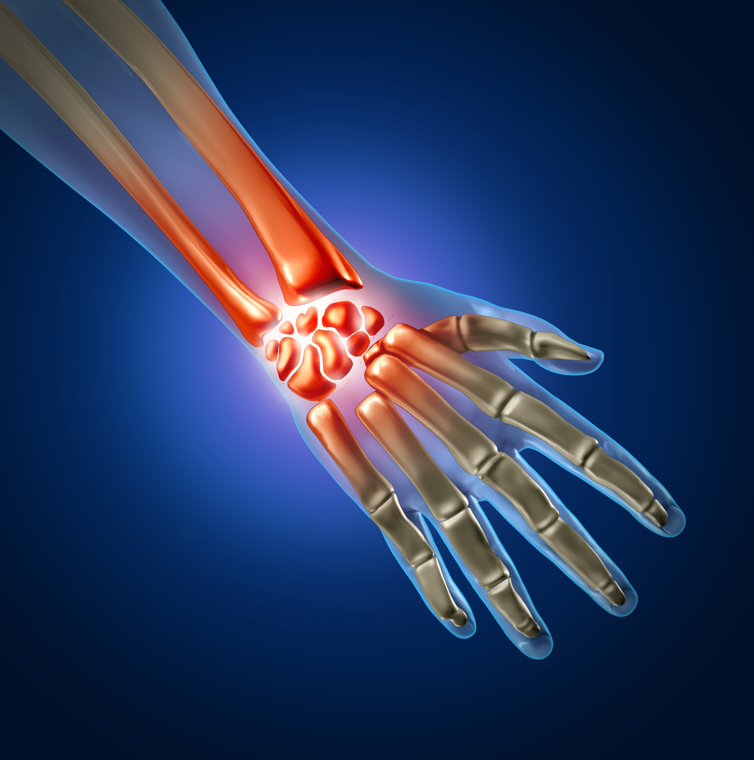 Wrist Fracture FAQs with an Orthopaedic Surgeon