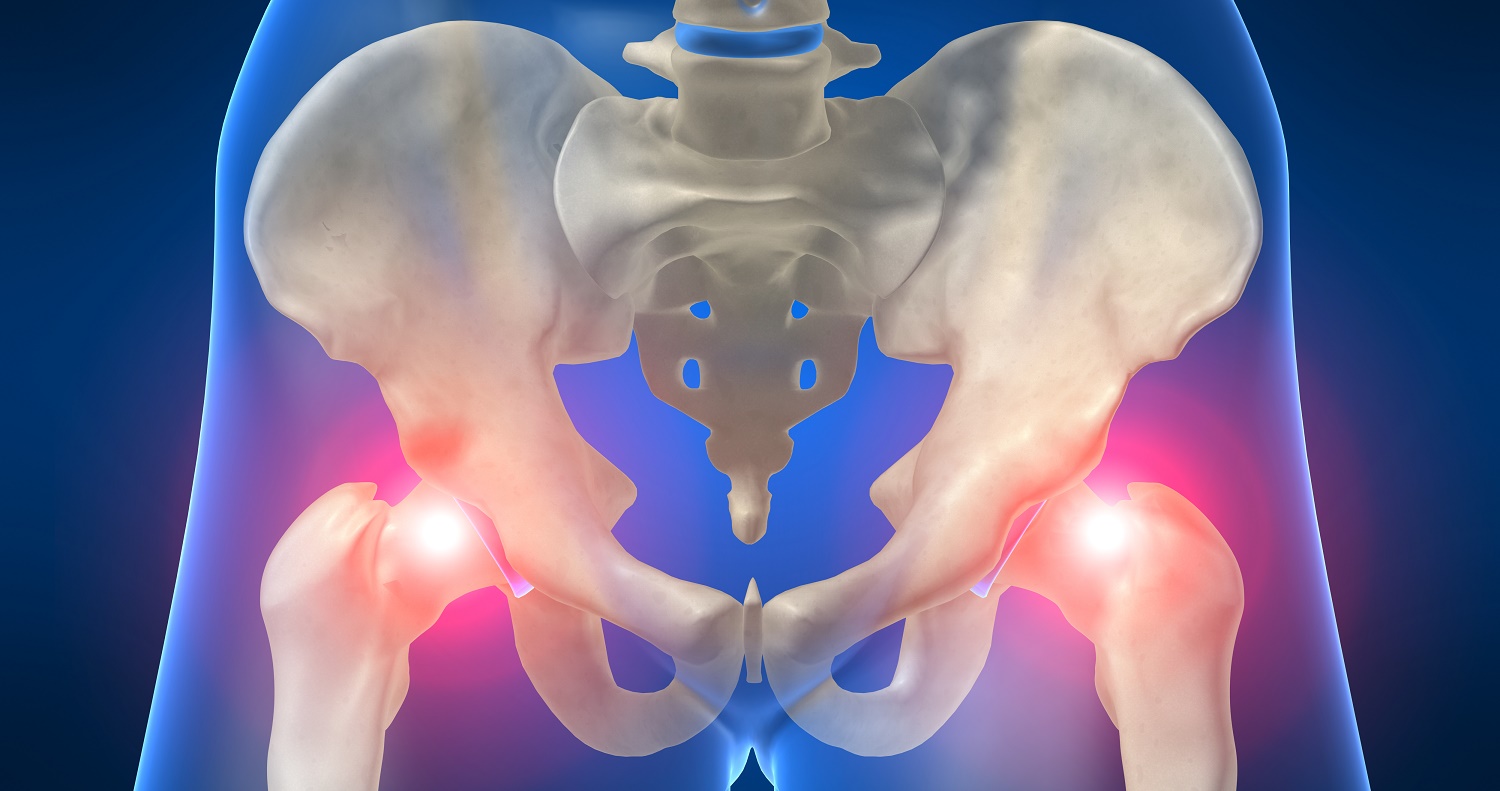 Finding Relief for Hip Osteoarthritis Pain