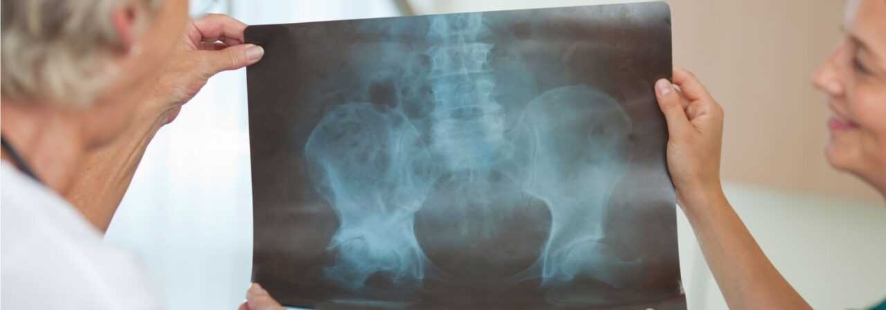 blog-arthro-hip-surgery-5-17-feature_optimized.jpg