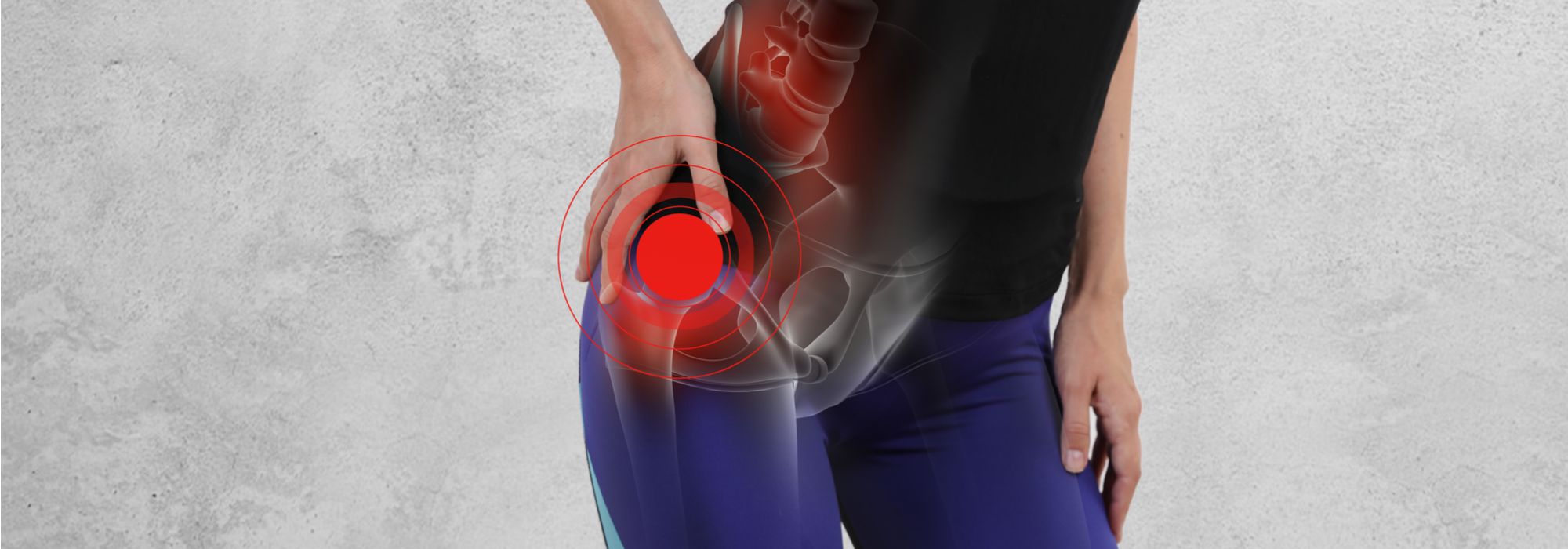 FAQs About Torn Hip Labrum Injuries