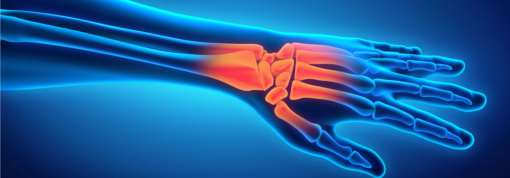 Top FAQs about Seeing a Wrist Surgeon on the Lower East Side