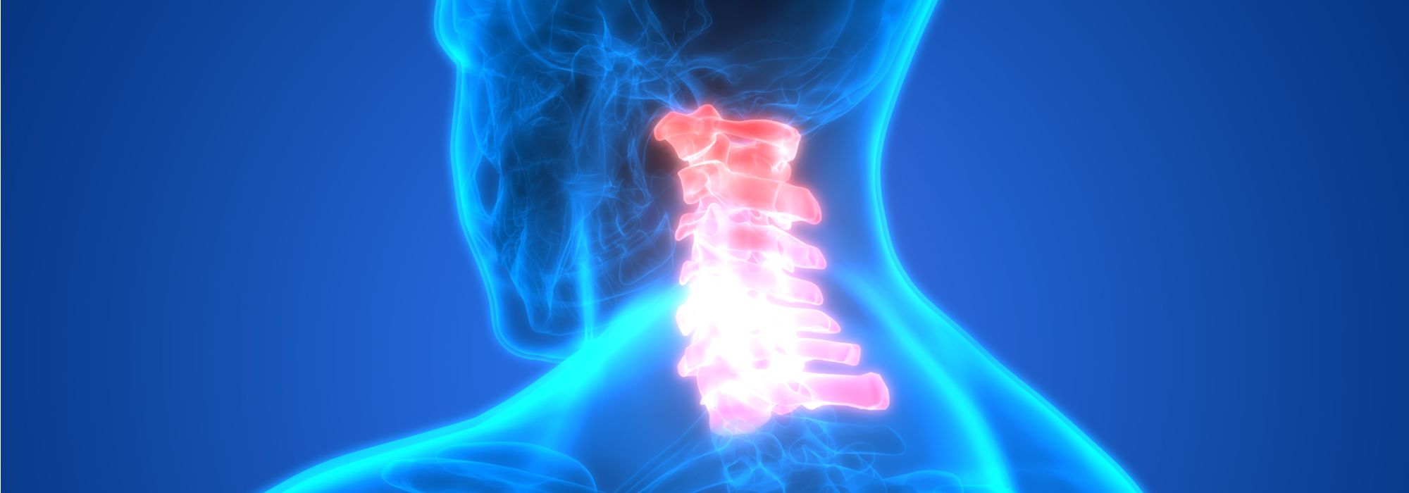 Effective Treatments for Cervical Herniated Discs