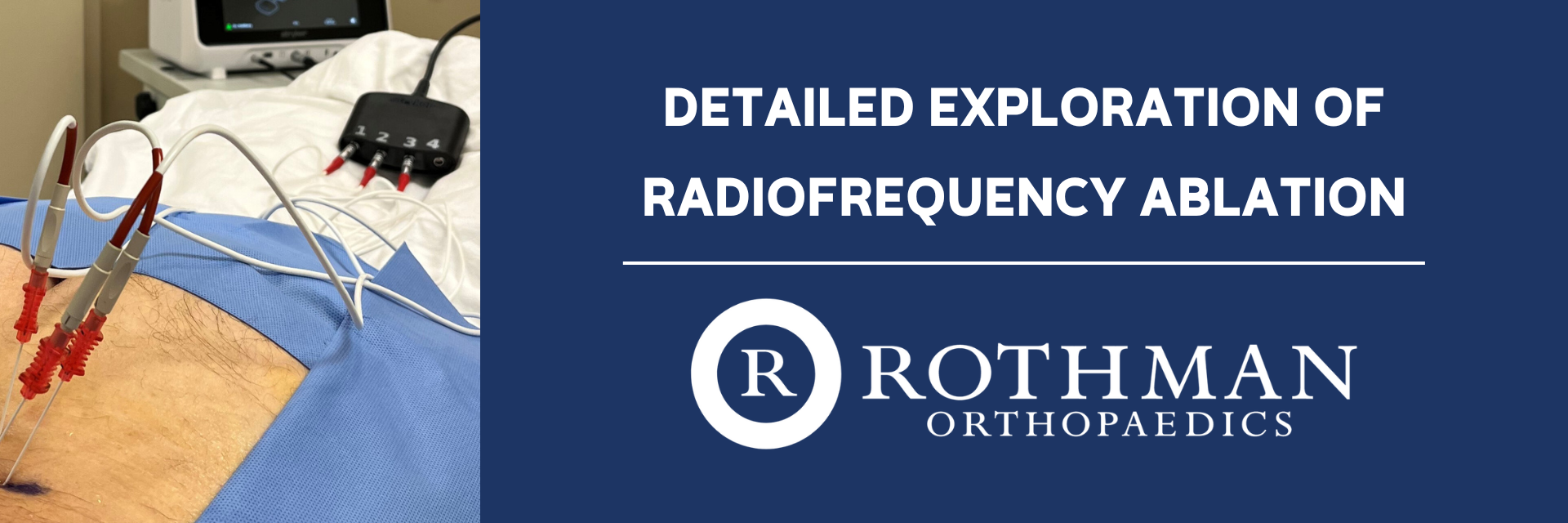 Detailed Exploration of Radiofrequency Ablation