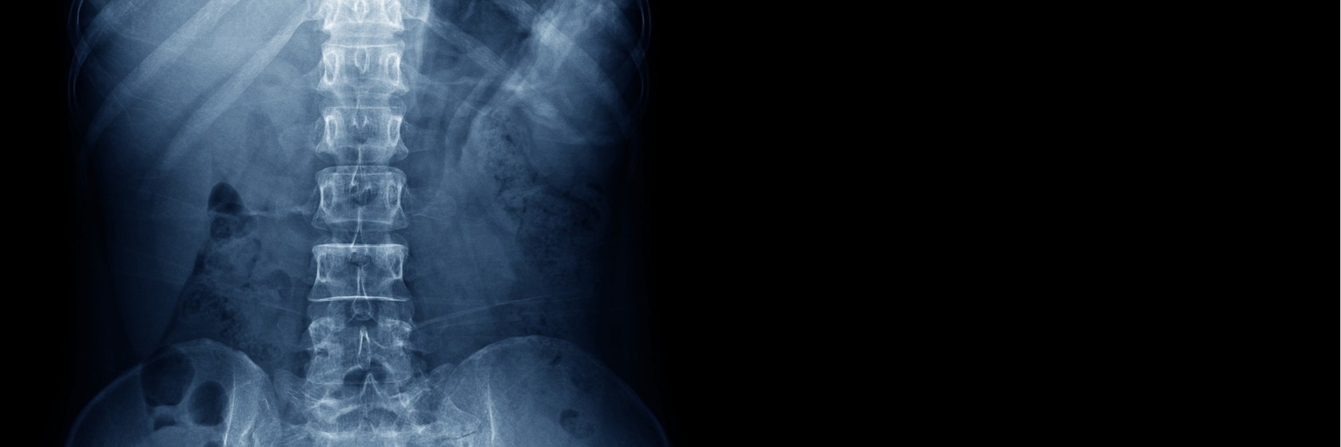 Best Sleeping Position for Neck and Low Back Pain