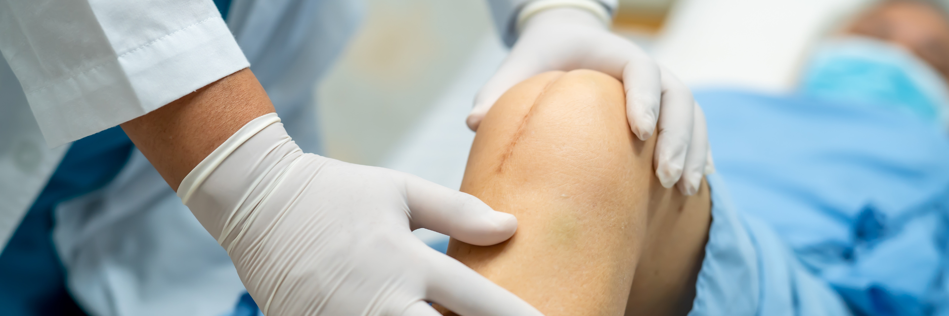 When is Revision Surgery Necessary for Knee Replacements?