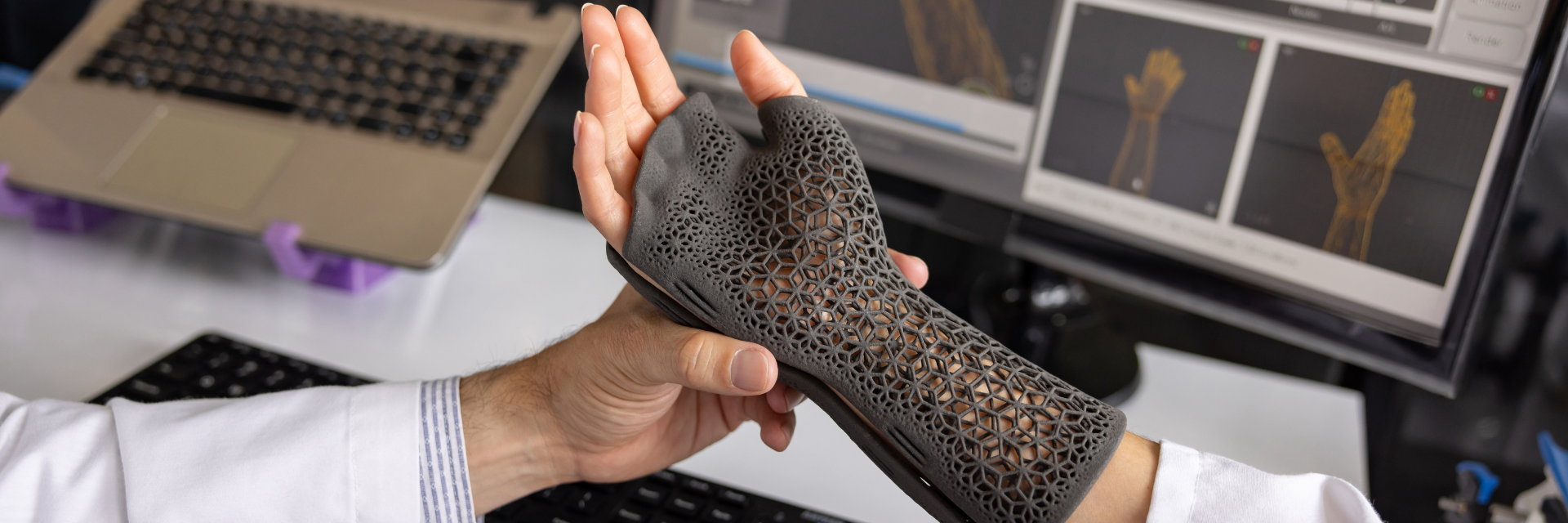 The Role of 3D-Printed Splints in Hand Injury Treatment